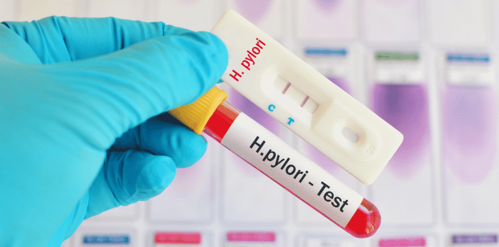helicobacter pylori 